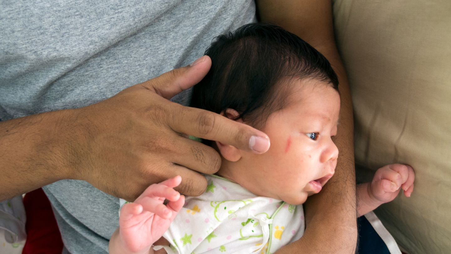 What to Do If Your Child Has a Facial Mass or Lesion?